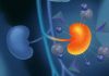 Kidney Cancer: Know the 4 Stages of This Disease
