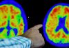 Donanemab found to slow Alzheimer’s and hailed a ‘turning point in fight against disease’ | Science & Tech News
