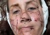 Three women injured in otter attack in Montana | US News