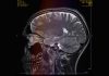 VC Pines: Soundtracking an epileptic brain – one musician’s story of seizures and synesthesia | Ents & Arts News