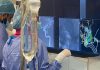 AI-driven technology could transform aneurysm treatment | Science & Tech News