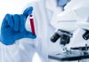 Blood test for Alzheimer’s disease could be as accurate as painful lumbar puncture, study suggests | Science & Tech News