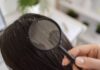 Dandruff: What is it, Causes, Treatment and Prevention Tips