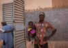 The forgotten crisis in Burkina Faso | Humanitarian Crises News