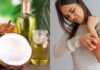 Coconut oil: Is it an effective home remedy for psoriasis?