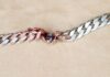 Necklace ‘saves man’s life’ after stopping bullet going into his neck, police say | US News