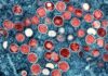 What is mpox and why has WHO declared it a global health emergency? | Health News