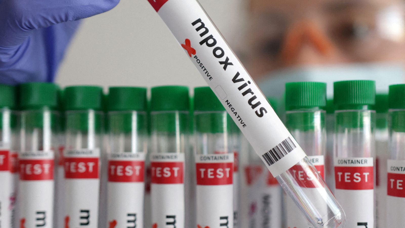 Mpox: Second case of deadlier Clade 1b variant confirmed outside Africa ...