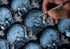 Pioneering Alzheimer’s drug rejected for widespread use in NHS in England | UK News