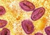 New case of mpox detected in UK