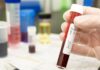 HIV deaths and infections will rise as a result of foreign aid cuts, study warns | World News