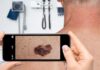 Should you avoid AI skin apps? A dermatologist answers