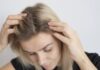 6 quick fixes for oily, sticky dandruff and a flake-free scalp