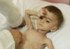 Crying babies dimmed by hunger fill this Afghanistan hospital – where parents fear each day might be the last | World News