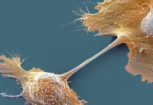 Breakthrough drug nearly doubles survival with advanced pancreatic cancer – an oncologist explains how daraxonrasib overcame an ‘undruggable’ disease