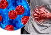 Cyclosporiasis sickens some people worse – why your diarrhea could be more explosive than others