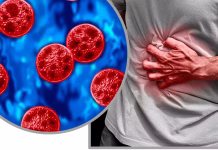 Cyclosporiasis sickens some people worse – why your diarrhea could be more explosive than others