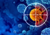 FDA approves breakthrough pancreatic cancer drug – an oncologist explains how daraxonrasib nearly doubles survival